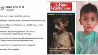 Разоблачение фальшивки: истощенный ребенок из Газы не голодает из-за войны, как написала газета, а лечится от муковисцидоза в Италии на деньги Израиля