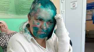 Елена Милашина после нападения